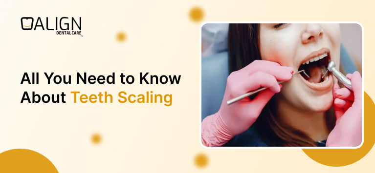 Teeth scaling images