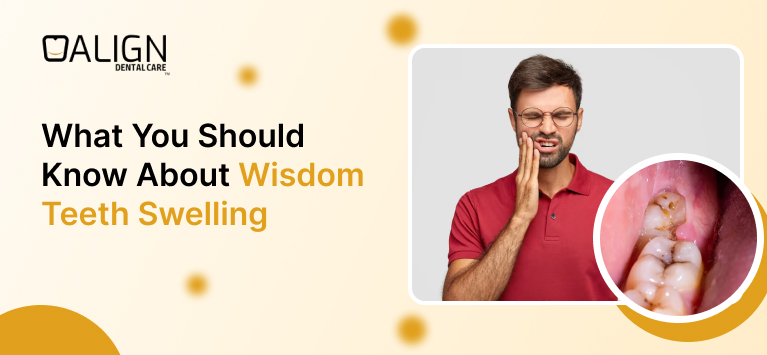 Wisdom tooth swelling