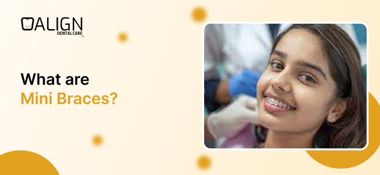 Mini braces