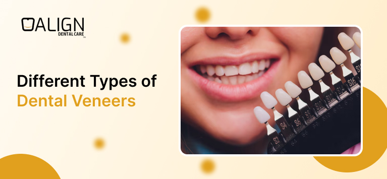 Different types of veneers
