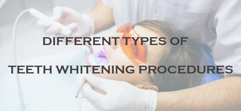 teeth whitening in dental