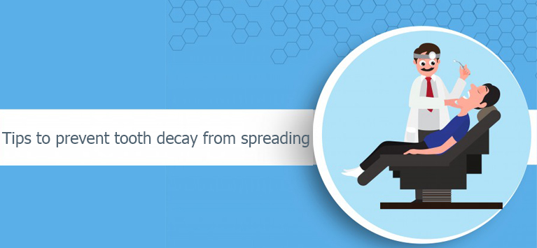 man with tooth decay