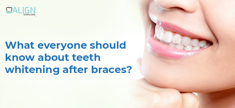 What everyone should know about teeth whitening after braces