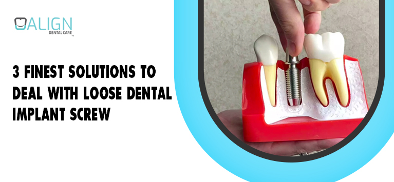 3 finest solutions to deal with loose dental implant screw