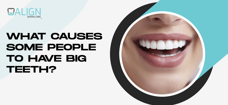 What causes some people to have big teeth?