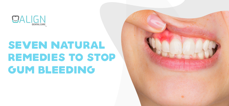7 natural remedies to stop gum bleeding