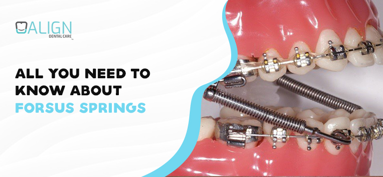 All You Need to Know About Forsus Springs