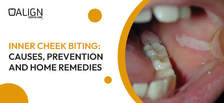inner-cheek-biting-causes-prevention-and-home-remedies