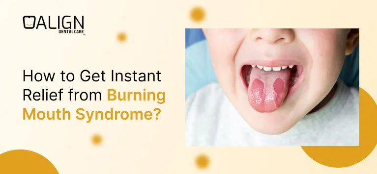 burning mouth syndrome