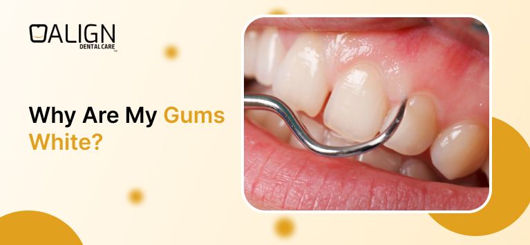 pictures of white gums