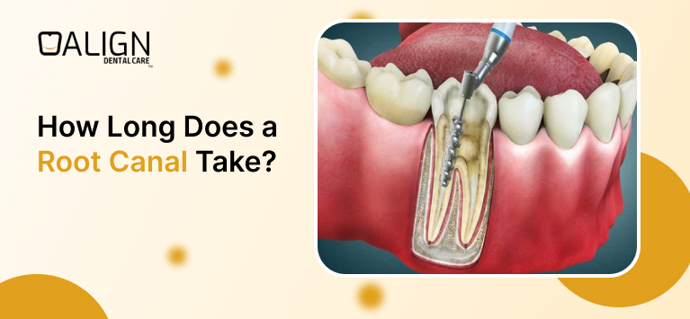 How Long Does a Root Canal Take