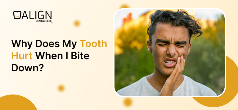 Why Does My Tooth Hurt When I Bite Down