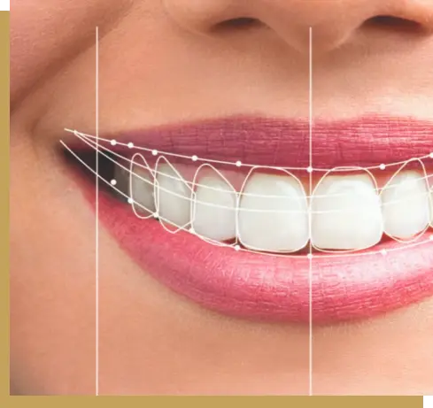 Digital Smile Design