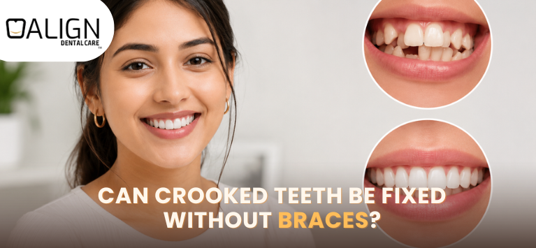 Can Crooked Teeth Be Fixed Without Braces?